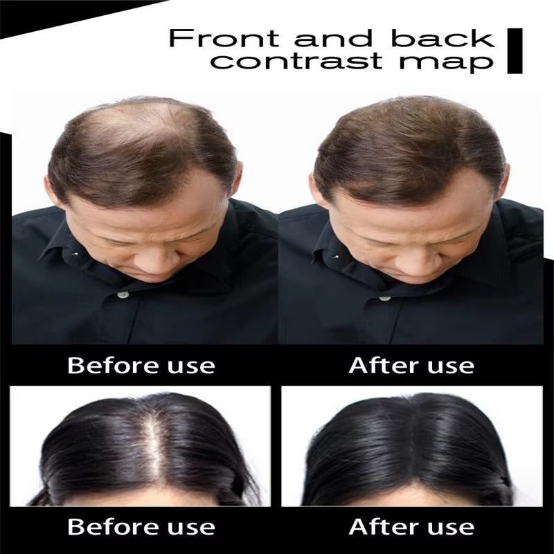 27.5G Hair Fibers Keratin Thickening Original Hair Growth Powder